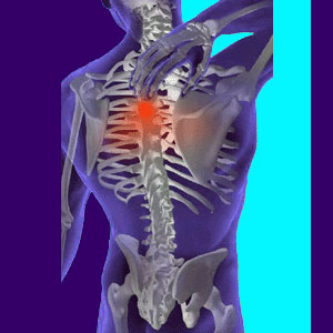 Back Problem - Back Pain