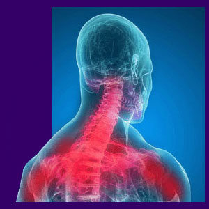 Cervical Pain - Back Pain