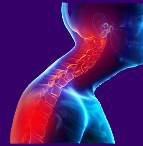 Cervicogenic Headache