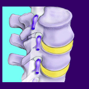 Effects of aging on joints image