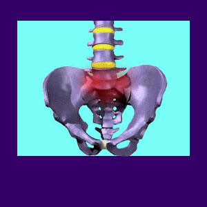 Does Sacralization Cause Back Pain