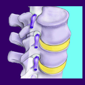 Facet Joint Therapy