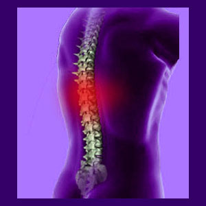 scoliosis nonstructural