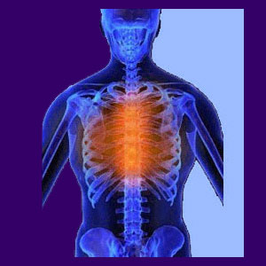 Severe Back Pain