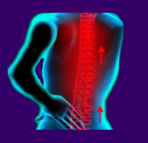 Spinal Shock When Walking